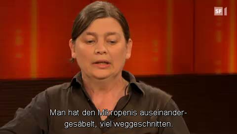 Man hat den Mikropenis auseinandergesäbelt, viel weggeschnitten.