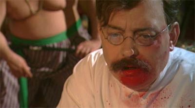 Hirschfeld operiert mit Blut im Gesicht